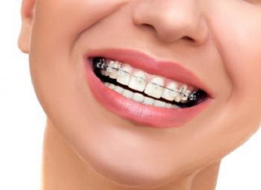Dental Clinic in Engineering College lucknow,Dental Clinic in vibhuti khand,Dental clinic in vishesh khand,dental clinic near shaheed path,Dentist in Gomti Nagar,Dentist in vibhuti khand,Dentist in vishesh khand,Dentist near shaheed path,Dental clinic in lucknow,dentist in lucknow,top dental clinic in gomti nagar,top dental clinic in vibhuti khand,top dental clinic in vishesh khand,top dental clinic  near shaheed path,top dentist in gomti nagar,top dentist in vibhuti khand,top dentist in vishesh khand