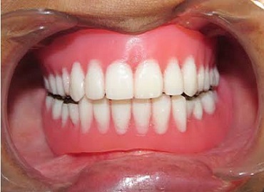 Dental Clinic in Engineering Colleges lucknow,Dental Clinic in vibhuti khand,Dental clinic in vishesh khand,dental clinic near shaheed path,Dentist in Gomti Nagar,Dentist in vibhuti khand,Dentist in vishesh khand,Dentist near shaheed path,Dental clinic in lucknow,dentist in lucknow,top dental clinic in gomti nagar,top dental clinic in vibhuti khand,top dental clinic in vishesh khand,top dental clinic  near shaheed path,top dentist in gomti nagar,top dentist in vibhuti khand,top dentist in vishesh khand