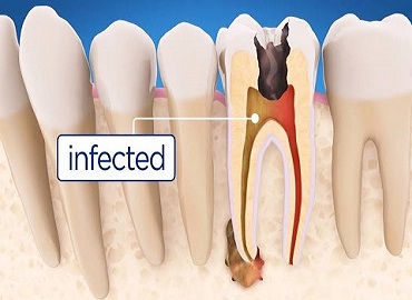 Dental Clinic in Gomti Nagar,Dental Clinic in vibhuti khand,Dental clinic in vishesh khand,dental clinic near shaheed path,Dentist in Gomti Nagar,Dentist in vibhuti khand,Dentist in vishesh khand,Dentist near shaheed path,Dental clinic in lucknow,dentist in lucknow,top dental clinic in gomti nagar,top dental clinic in vibhuti khand,top dental clinic in vishesh khand,top dental clinic  near shaheed path,top dentist in gomti nagar,top dentist in vibhuti khand,top dentist in vishesh khand