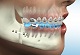 White 32 Ortho Dental