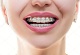 White 32 Ortho Dental Clinic